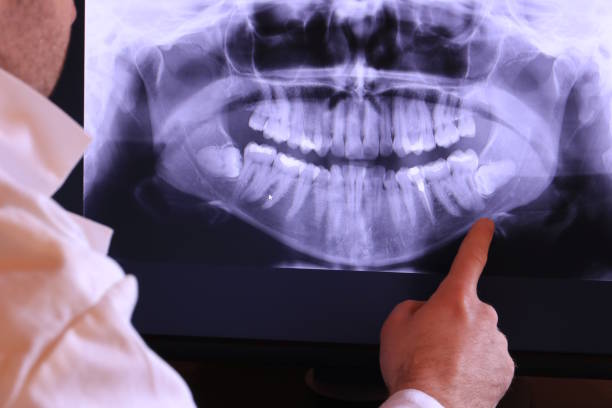 Best Broken or Chipped Tooth Repair in Tucker, GA