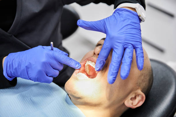 Best Dental Abscess Treatment in Tucker, GA